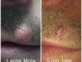 mole1web mole1web