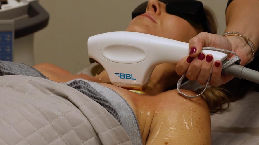 BBL-body1